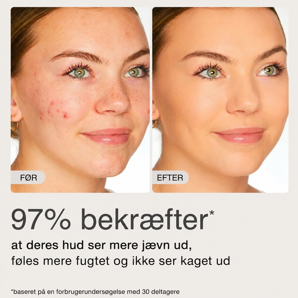 Mirelle™ BB Blur – Tonet Fugtighedscreme SPF 30
